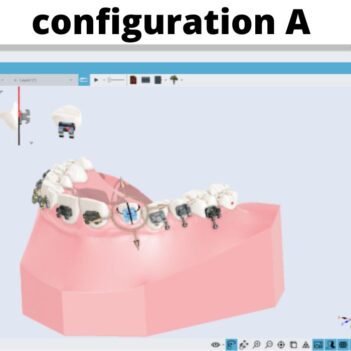 Logiciel d'orthodontie Maestro 3D - Configuration A