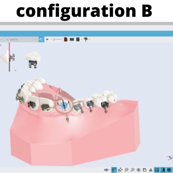Logiciel d'orthodontie Maestro 3D - Configuration B