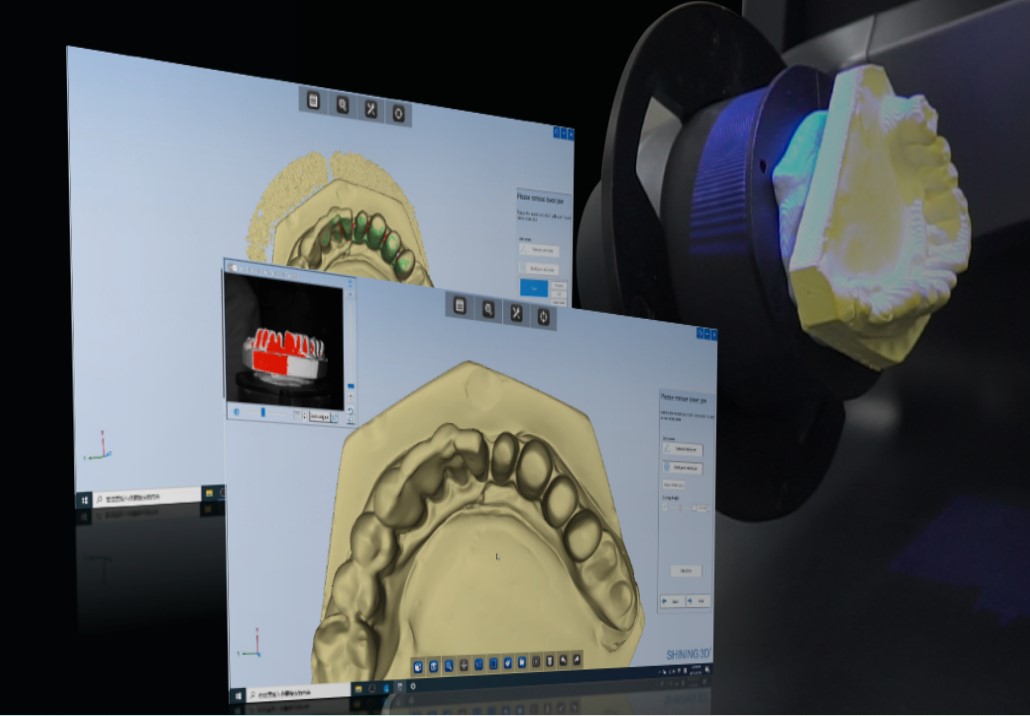 Scanner 3D Dentaire AutoScan DS-MIX