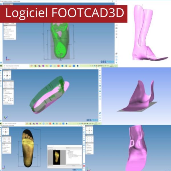 logiciel FOOTCAD3D SEMELLES ORTHOPÉDIQUES IMPRESSION 3D